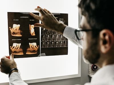 Root Canal Treatment